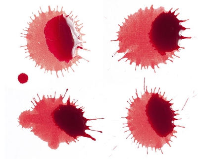Causes Of Bleeding 10 Days After Period Ended Causes Of Bleeding 10 Days After Period Ended